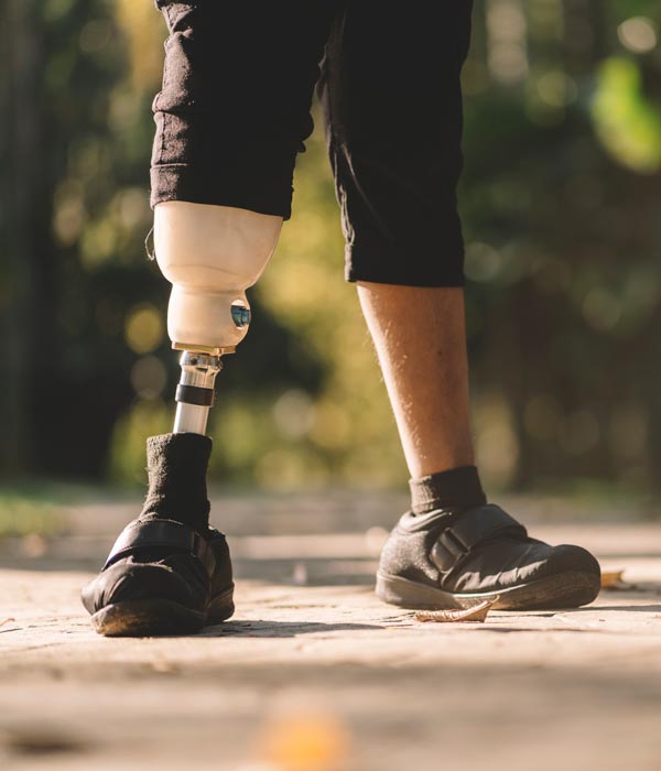 man with prosthetic leg