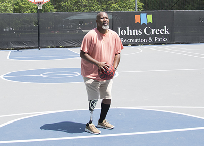 Fourroux Prosthetics-Atlanta_Clarence_500x357_thumb