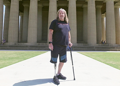 Fourroux-Prosthetics-HSV Mick_500x357_thumb