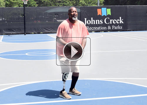 Fourroux-Prosthetics-Atlanta_Clarence_500x357_thumb