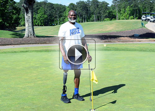 Fourroux-Prosthetics-Atlanta_Leonard_500x357_thumb-300x214