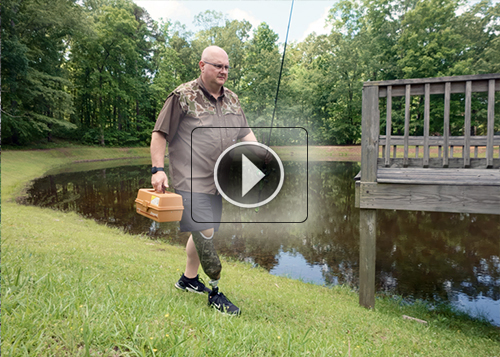 Fourroux-Prosthetics-BHAM-Eddie_500x357_thumb