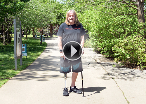 Fourroux-Prosthetics-HSV-Mick_500x357_thumb