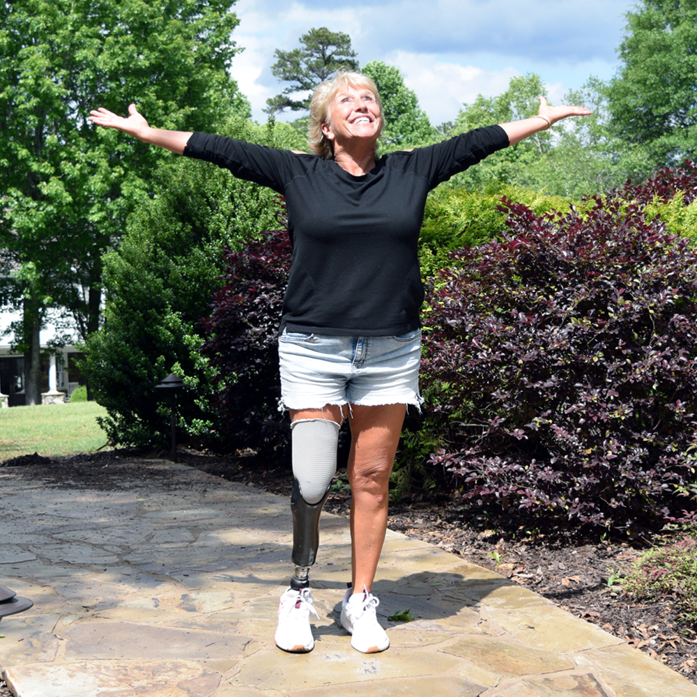 Fourroux-Prosthetics_Active-Amputee_Kimmie Jo_1000x1000