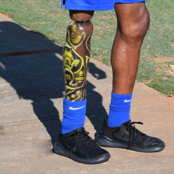 FourrouxProsthetics_Services_Our Approach