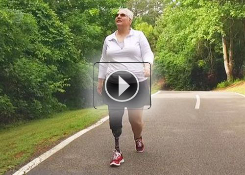 fourroux-patients-peggy