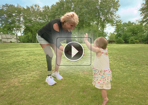 Fourroux-Prosthetics-Atlanta_Kimmie Jo_500x357_thumb-300x214-2